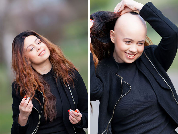 I Captured The Beautiful TV Reporter Who Decided To Embrace Her Alopecia