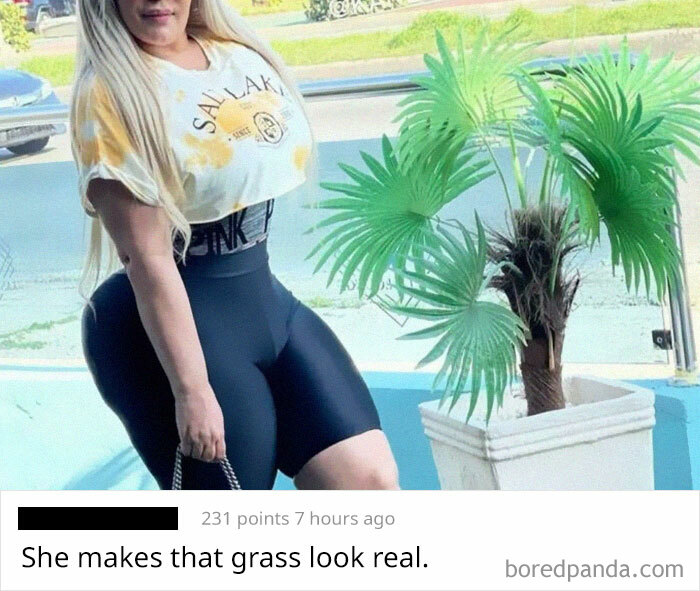 Witnessed This Third Degree Burn