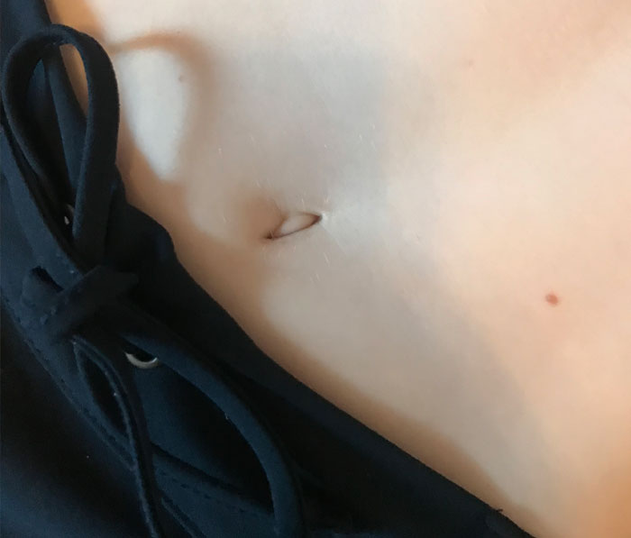 Person Invites You To Learn 'How Rare Is Your Body?' In His Viral Series