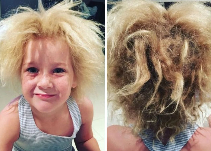 Person Invites You To Learn 'How Rare Is Your Body?' In His Viral Series