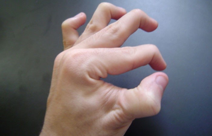 Person Invites You To Learn 'How Rare Is Your Body?' In His Viral Series