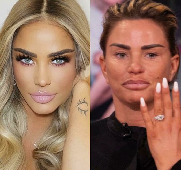 Instagram Post V A Live TV Appearance - Both Taken On The Same Day. She Doesn’t Even Look Like The Same Person