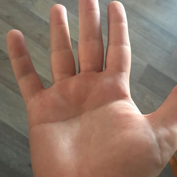 Person Invites You To Learn 'How Rare Is Your Body?' In His Viral Series