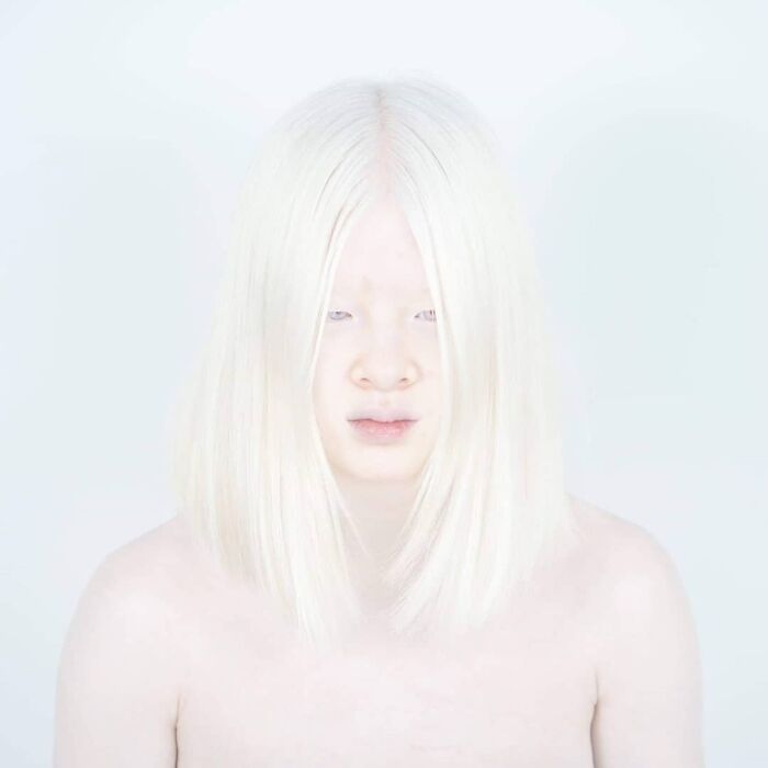 Xueli-Abbing-Chinese-Albino-Fashion-Model-Xueli-A