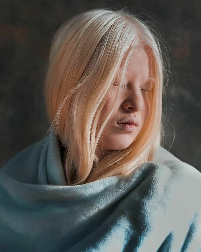 Xueli-Abbing-Chinese-Albino-Fashion-Model-Xueli-A