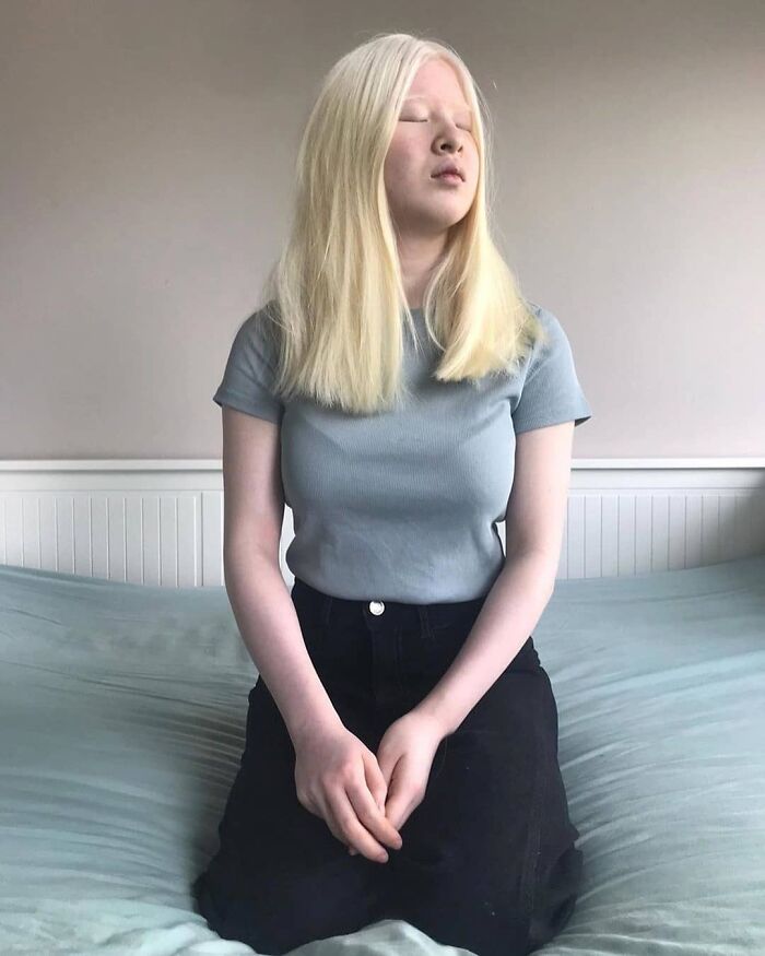 Xueli-Abbing-Chinese-Albino-Fashion-Model-Xueli-A