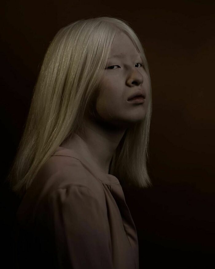Xueli-Abbing-Chinese-Albino-Fashion-Model-Xueli-A