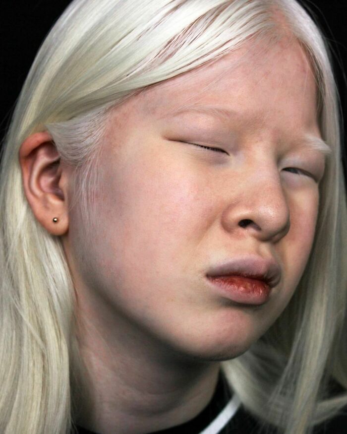 Xueli-Abbing-Chinese-Albino-Fashion-Model-Xueli-A