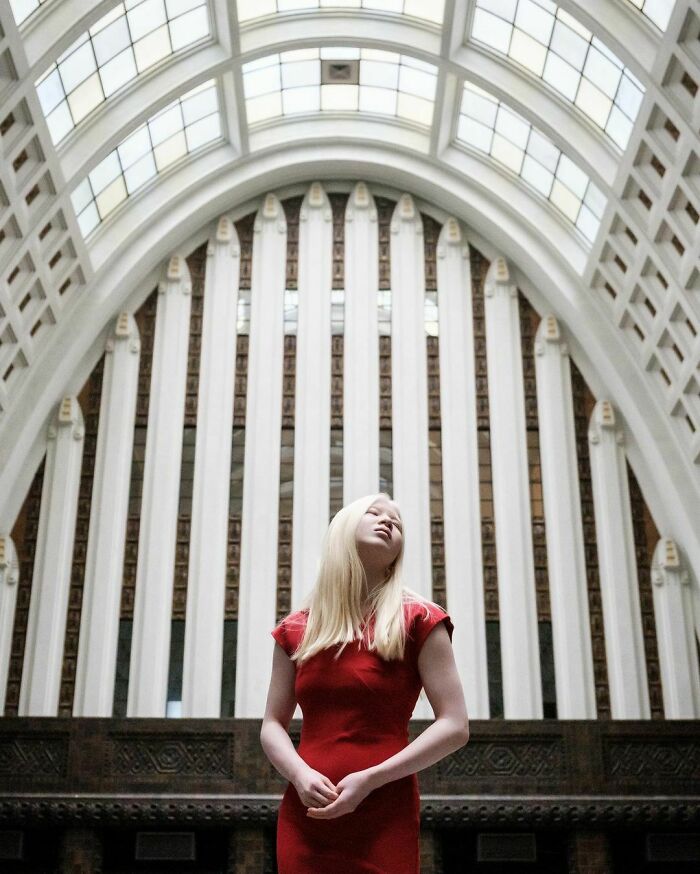 Xueli-Abbing-Chinese-Albino-Fashion-Model-Xueli-A