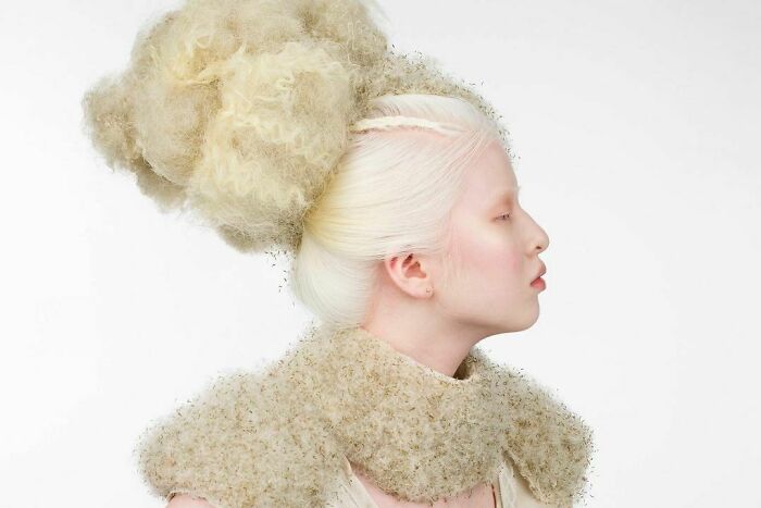 Xueli-Abbing-Chinese-Albino-Fashion-Model-Xueli-A