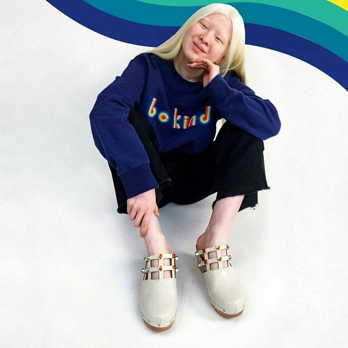 Xueli-Abbing-Chinese-Albino-Fashion-Model-Xueli-A