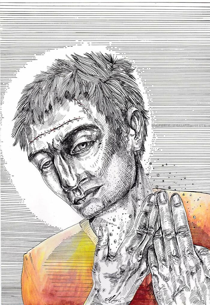 My Rendition Of A Lobotomized Patient, Ink And Watercolor