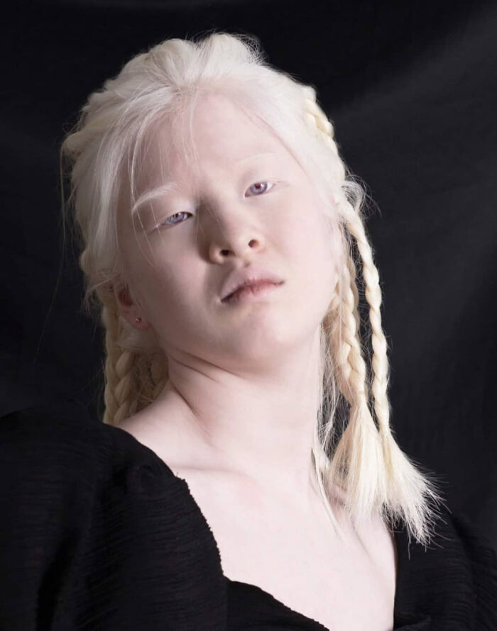 Xueli-Abbing-Chinese-Albino-Fashion-Model-Xueli-A