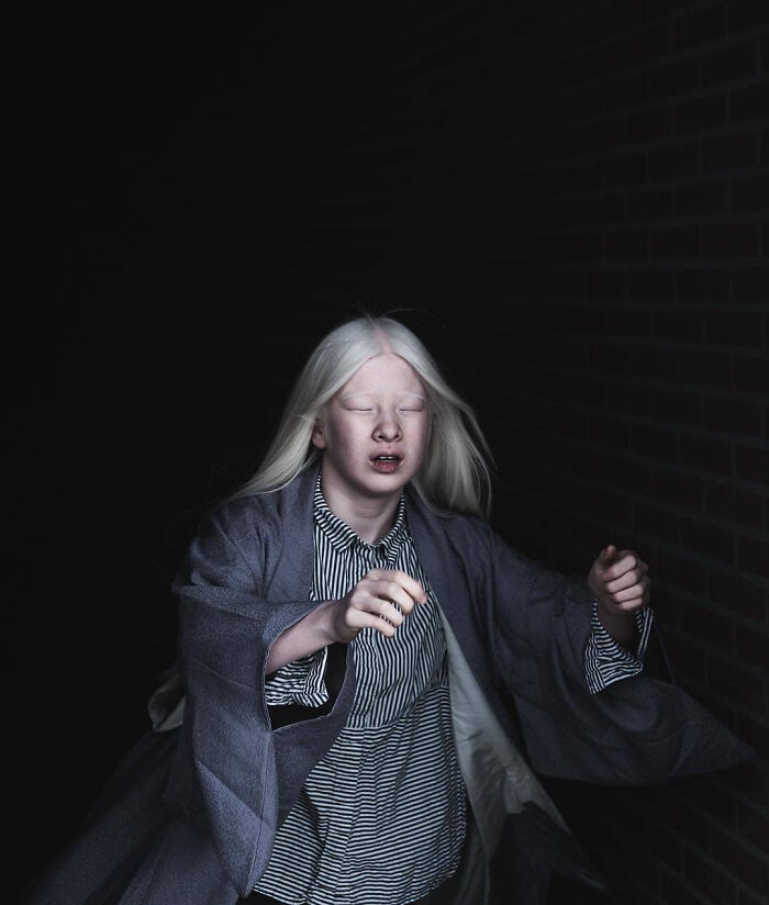 Xueli-Abbing-Chinese-Albino-Fashion-Model-Xueli-A