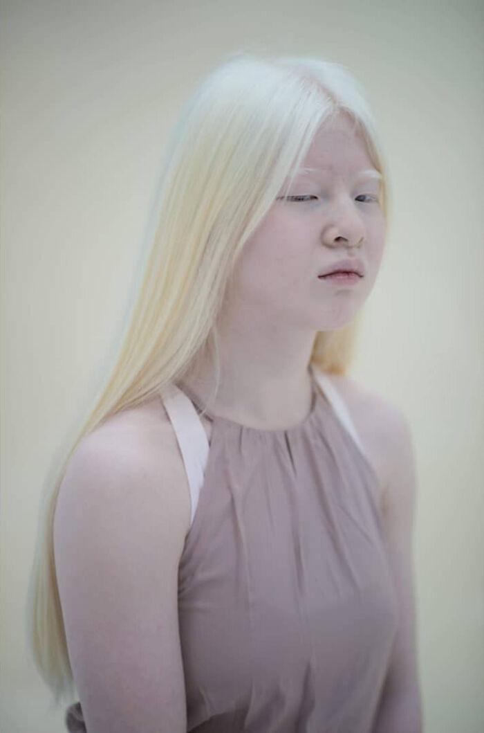 Xueli-Abbing-Chinese-Albino-Fashion-Model-Xueli-A