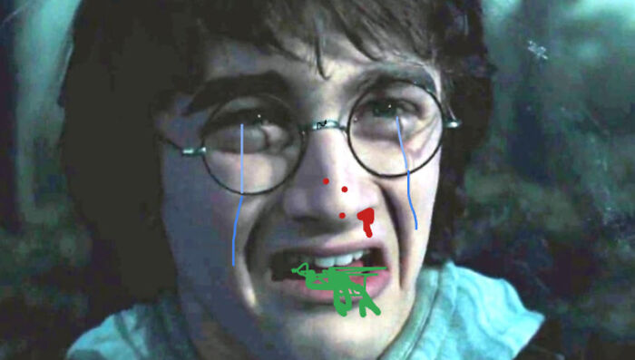 Poor Harry