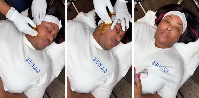 A TikToker Shares Her Experience With Hirsutism In Hopes Of Raising Awareness And Educating People On The Condition A TikToker Shares Her Experience With Hirsutism In Hopes Of Raising Awareness And Educating People On The Condition