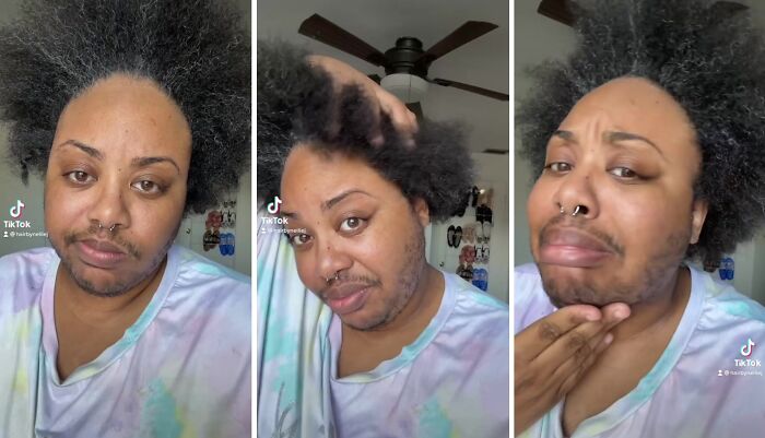 A TikToker Shares Her Experience With Hirsutism In Hopes Of Raising Awareness And Educating People On The Condition A TikToker Shares Her Experience With Hirsutism In Hopes Of Raising Awareness And Educating People On The Condition