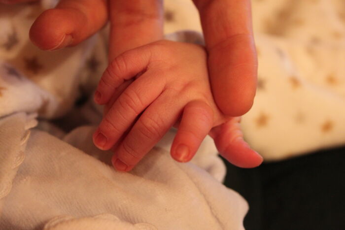 30 People In This Online Group Share Unexpected Features That Make Them 1% Of The Population