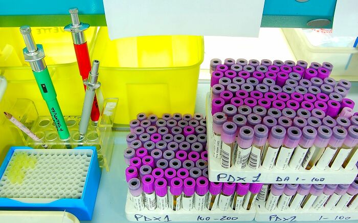 30 People In This Online Group Share Unexpected Features That Make Them 1% Of The Population