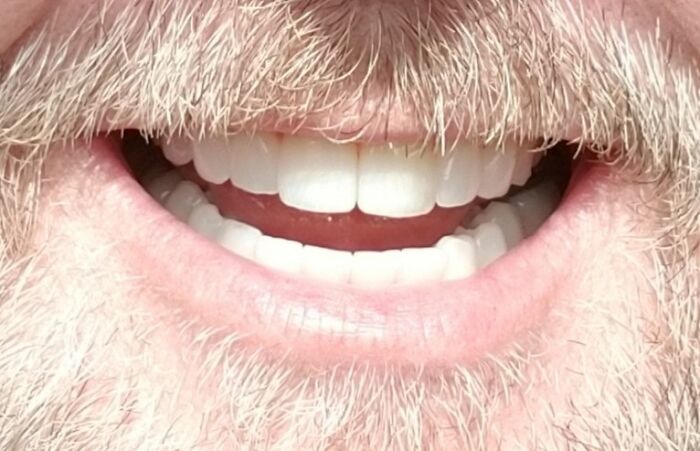 30 People In This Online Group Share Unexpected Features That Make Them 1% Of The Population