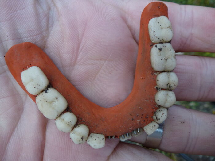 30 People In This Online Group Share Unexpected Features That Make Them 1% Of The Population