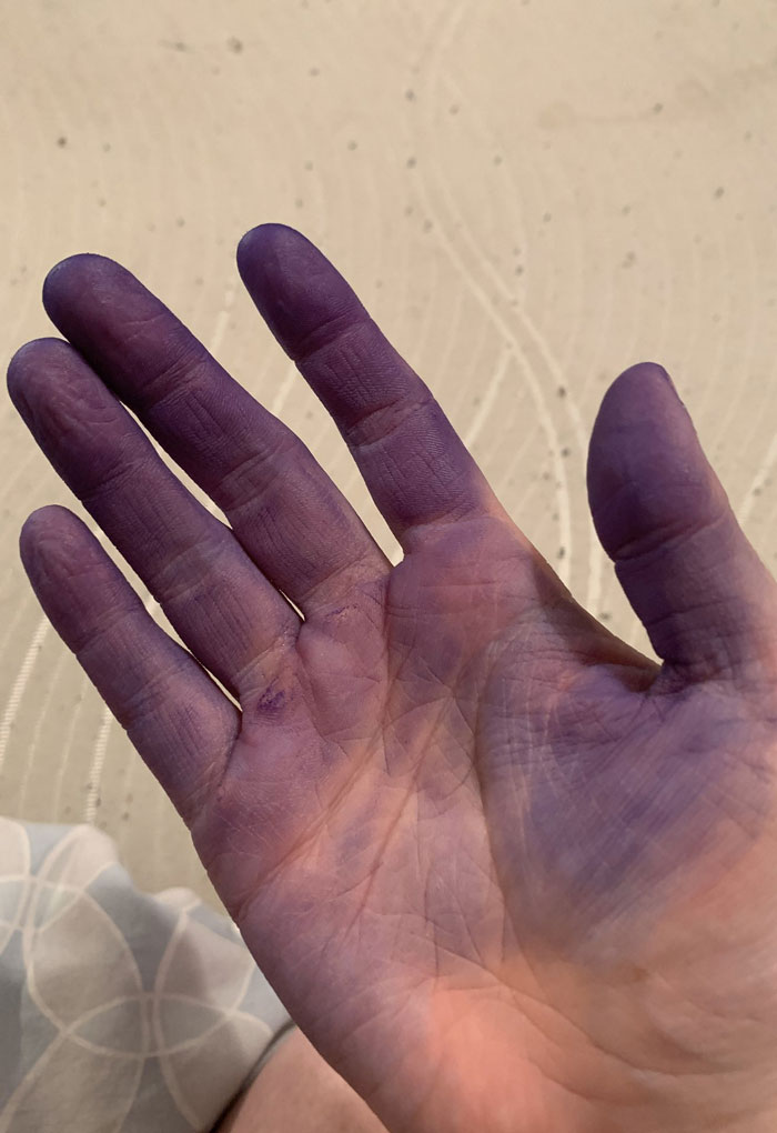 I’ve Been Indoors For A Couple Months Now And I’m Now Dyeing My Hair For The Second Time (And Yes It’s 1AM And I’m Home Alone And Covered In Hair Dye Right Now)