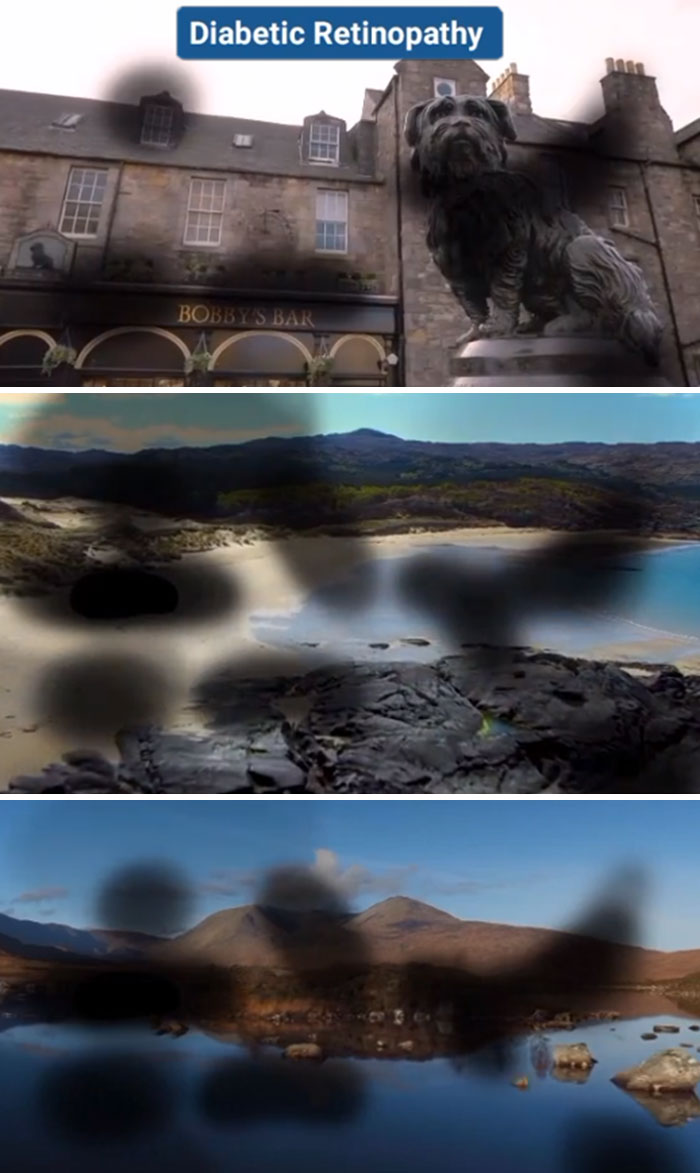 How-People-With-Certain-Medical-Conditions-See