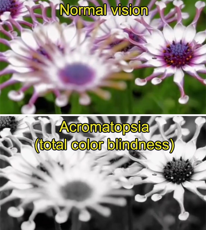 How-People-With-Certain-Medical-Conditions-See