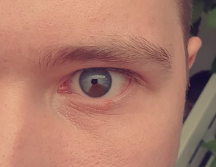 30 People In This Online Group Share Unexpected Features That Make Them 1% Of The Population