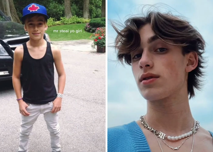 Tiktok-Glowup-Puberty-Before-After