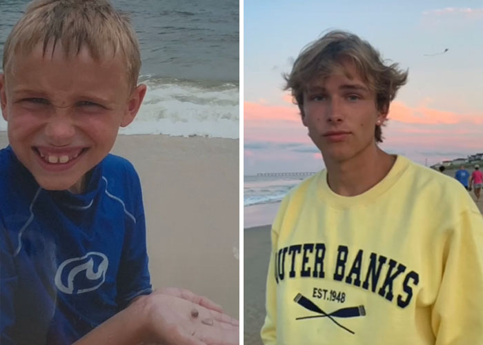 Tiktok-Glowup-Puberty-Before-After