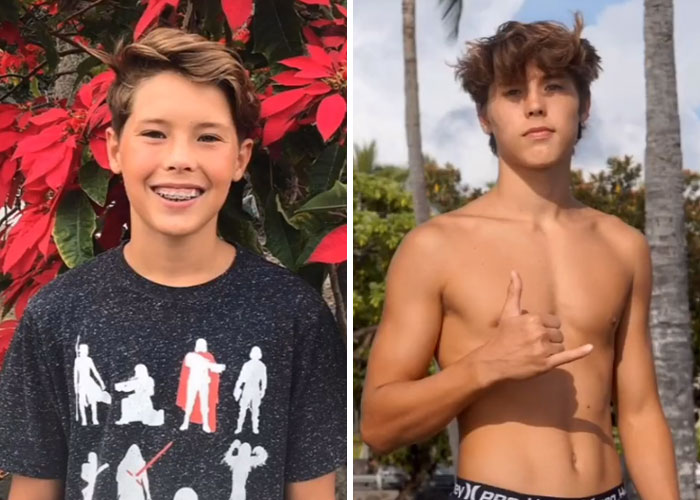 Tiktok-Glowup-Puberty-Before-After