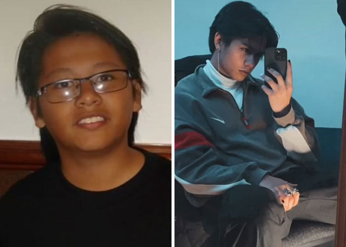 Tiktok-Glowup-Puberty-Before-After
