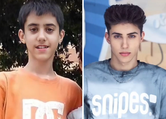Tiktok-Glowup-Puberty-Before-After