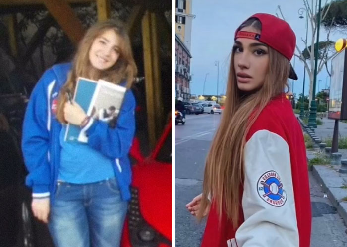 Tiktok-Glowup-Puberty-Before-After