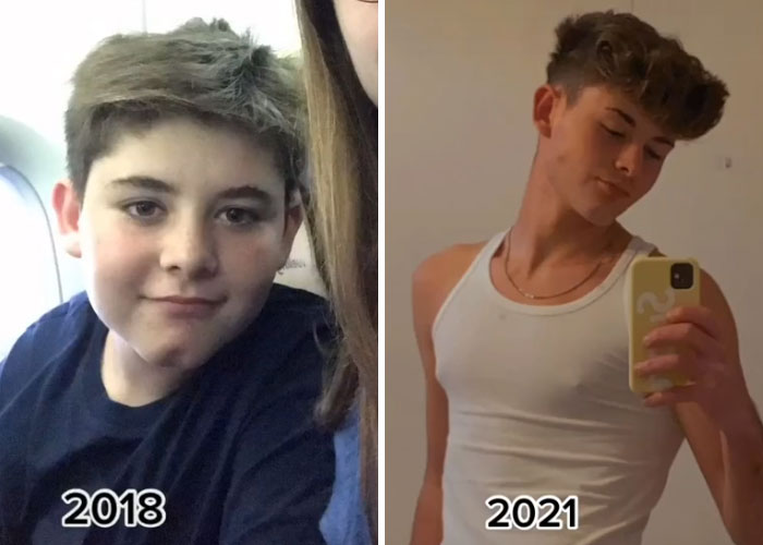 Tiktok-Glowup-Puberty-Before-After