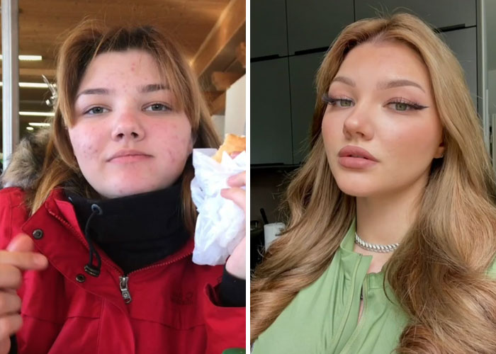 Tiktok-Glowup-Puberty-Before-After