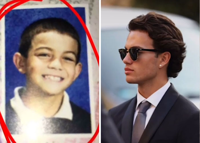 Tiktok-Glowup-Puberty-Before-After