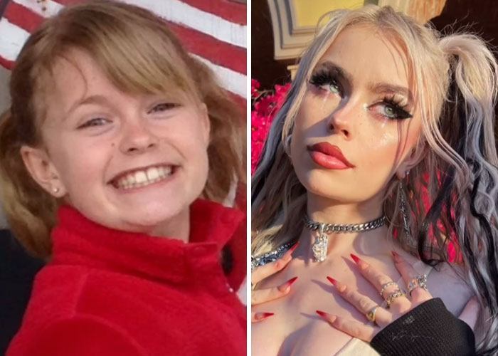 Tiktok-Glowup-Puberty-Before-After