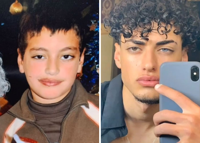 Tiktok-Glowup-Puberty-Before-After