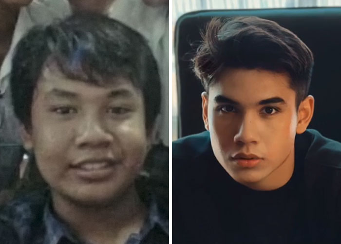 Tiktok-Glowup-Puberty-Before-After