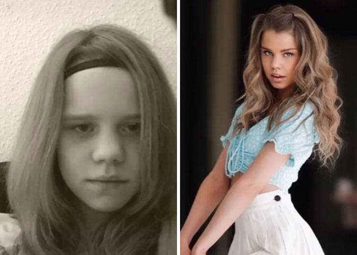 Tiktok-Glowup-Puberty-Before-After