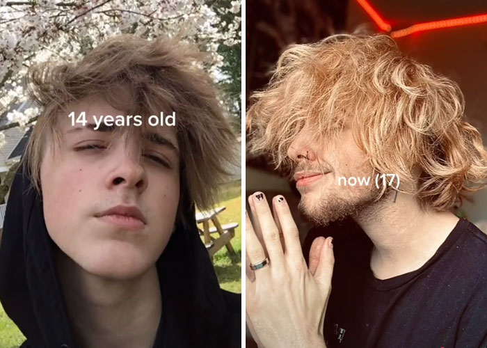 Tiktok-Glowup-Puberty-Before-After