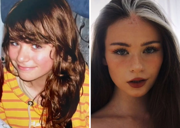 Tiktok-Glowup-Puberty-Before-After