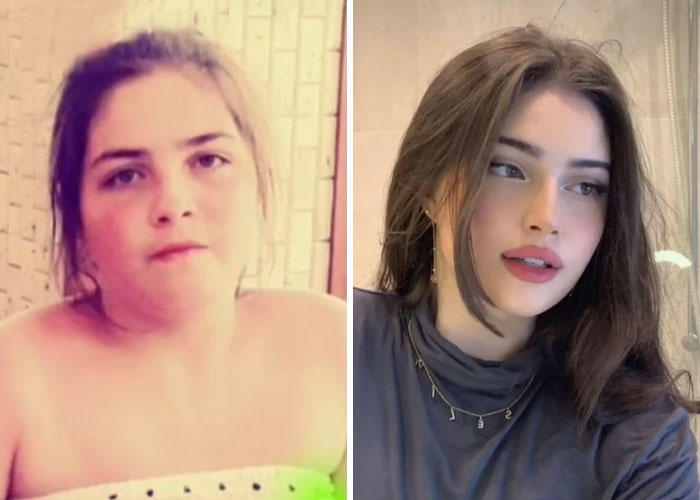 Tiktok-Glowup-Puberty-Before-After