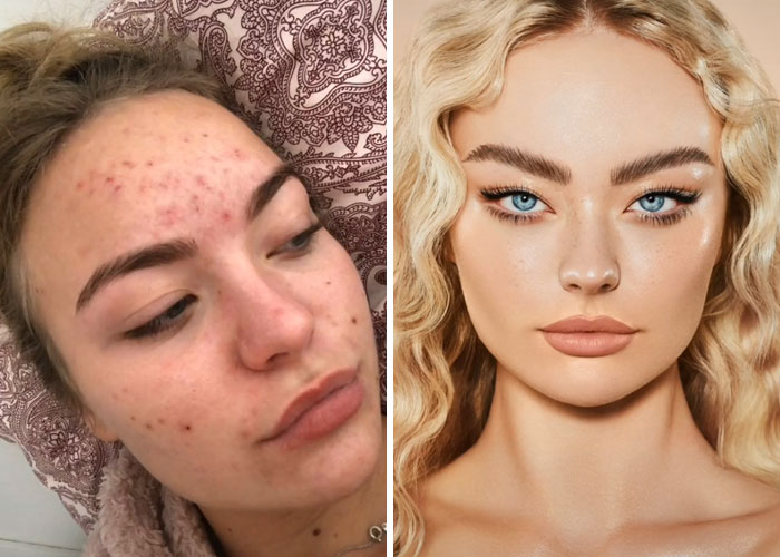 Tiktok-Glowup-Puberty-Before-After