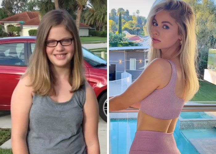 Tiktok-Glowup-Puberty-Before-After