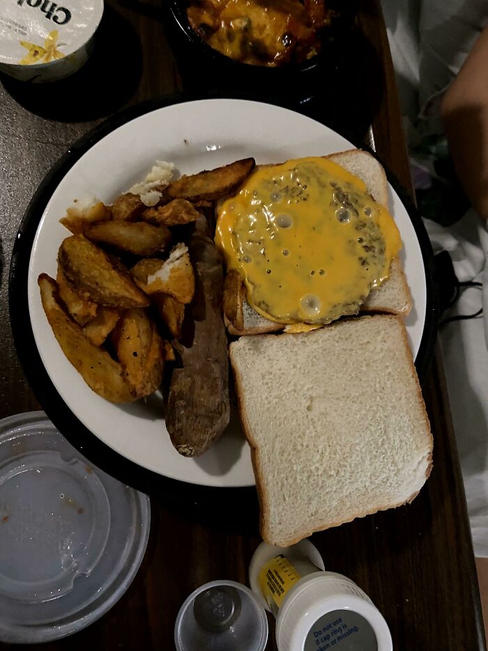 I Present An American Hospital Cheeseburger