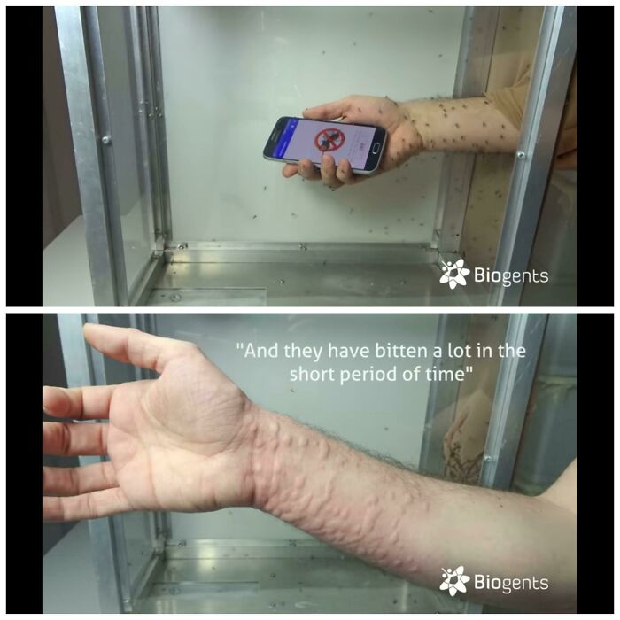 Sacrificed His Hand In The Name Of Science